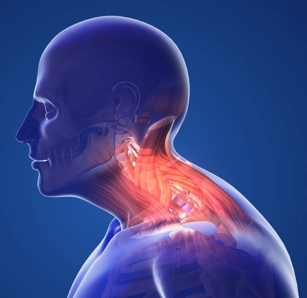 neck problem 2d illustration